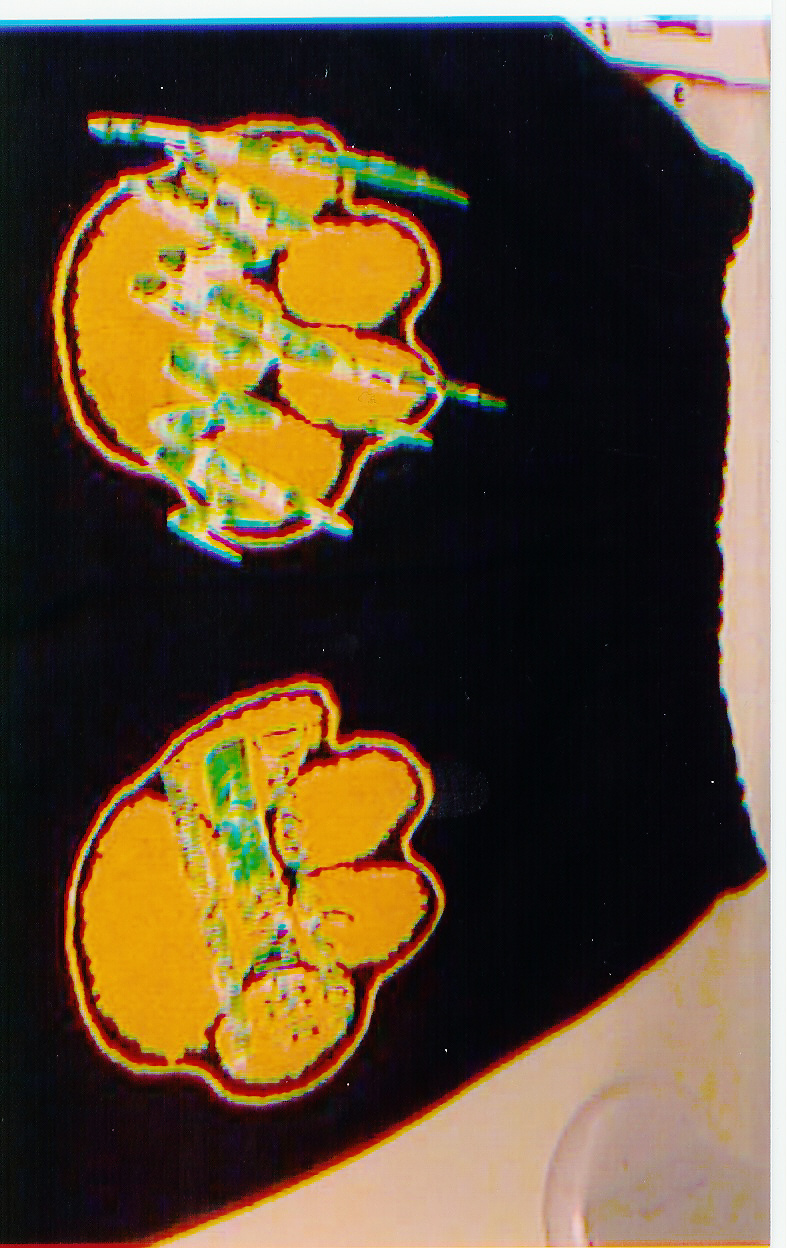 img1